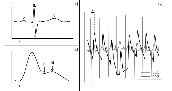 Photoplethysmography data graph